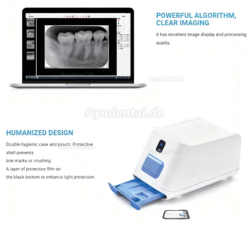 Runyes DS630 PSP Scanner digitales dentales R&ouml;ntgensystem f&uuml;r Speicherfolien